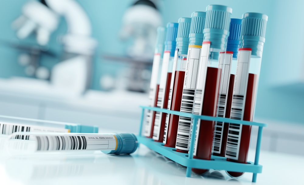 Blood samples and test results in a clinical medical laboratory