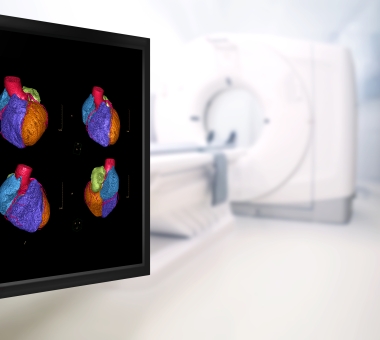 CTA Coronary artery 3D rendering image on the monitor in CT Scanner room