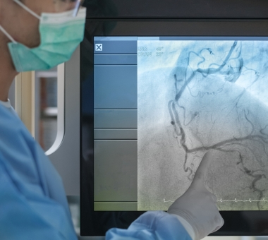 Coronary angiogram