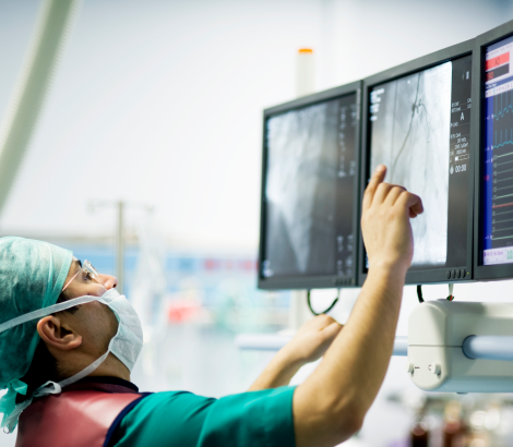 doctor viewing angiogram