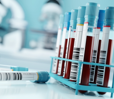Blood samples and test results in a clinical medical laboratory