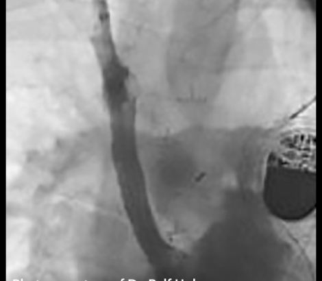 An angiograph image