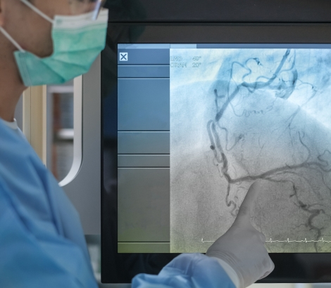 Coronary angiogram